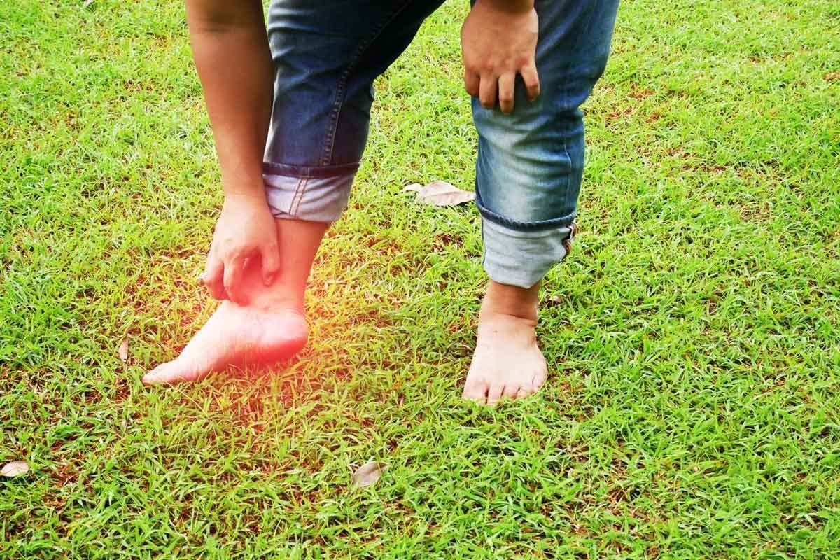 A person stands barefoot on green grass, scratching their ankle with one hand while the other hand supports them.
