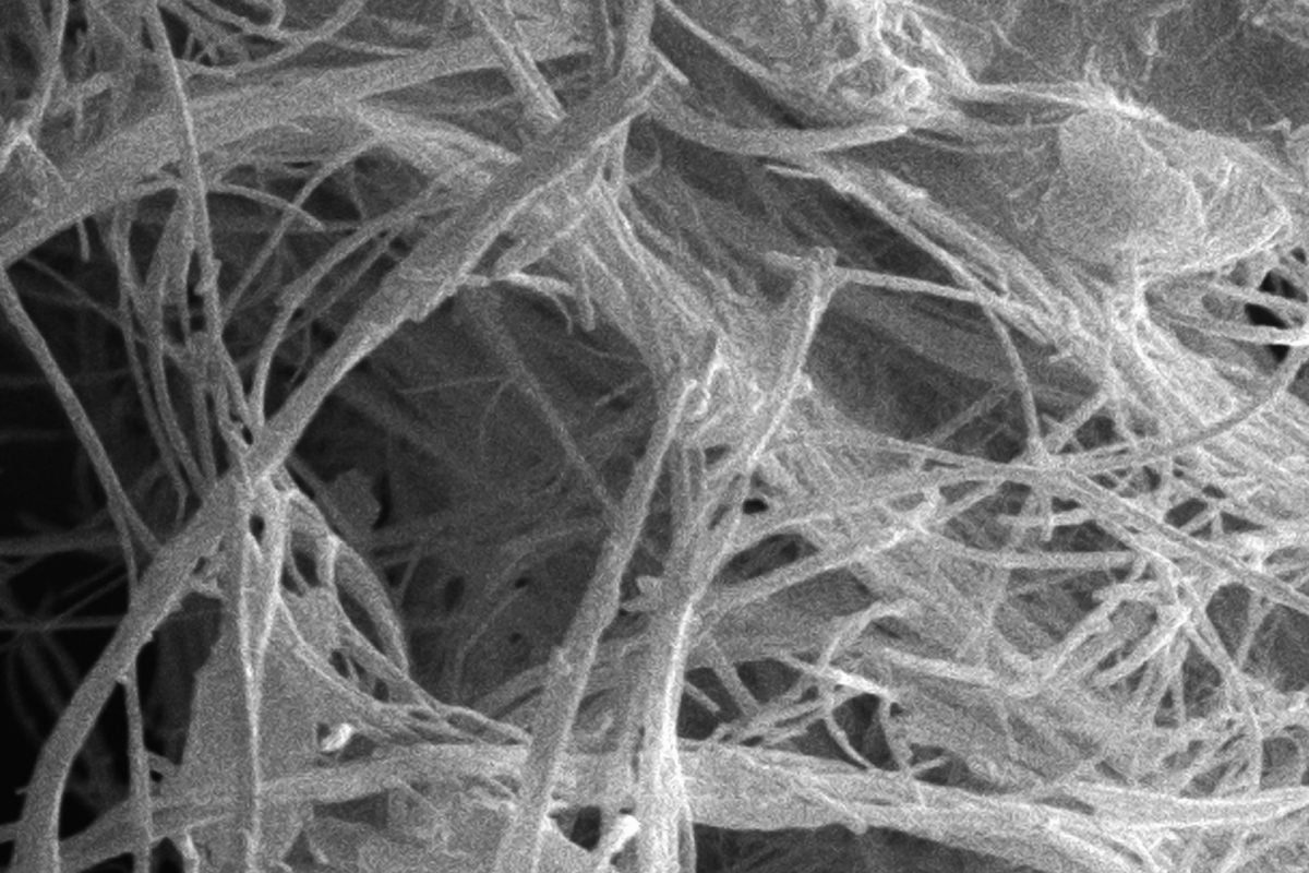 Scanning electron micrograph of asbestos