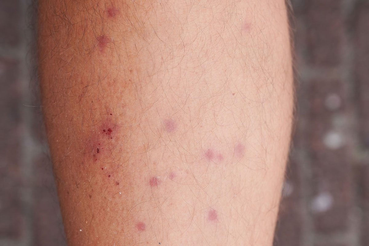 A leg shows reddish-pink spots and minor bleeding, indicating possible irritation or injury, set against a blurred background of pavement.
