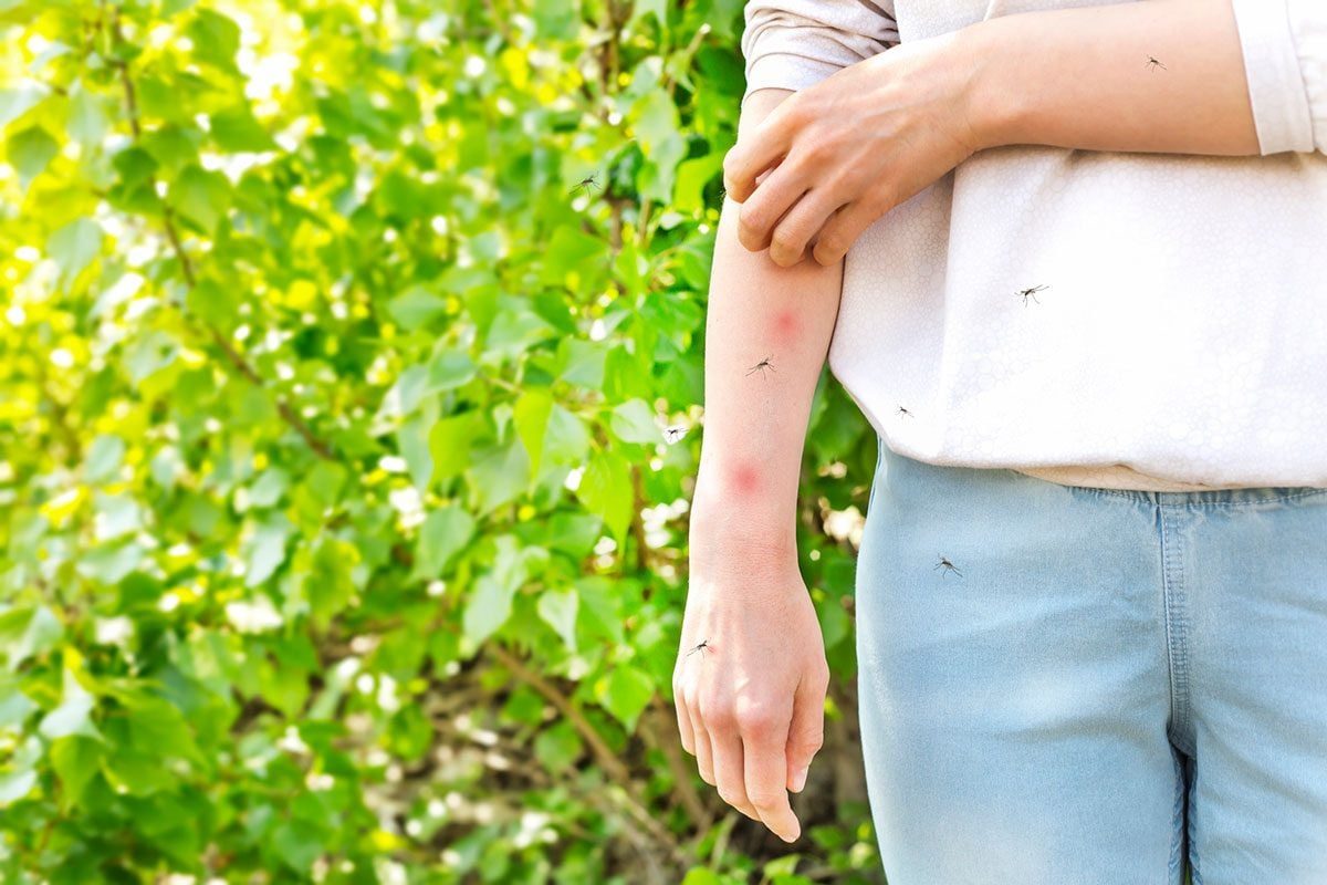 A person scratches their arm, which shows red mosquito bites, while several mosquitoes buzz around in a lush green outdoor setting.