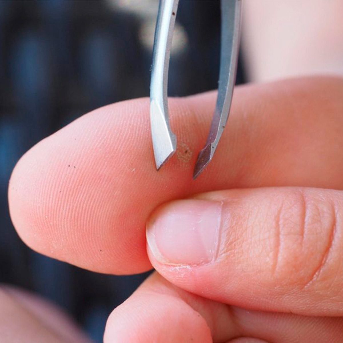 Tweezers grasp a small, embedded object on a fingertip, indicating a focus on its removal. The background appears softly blurred.