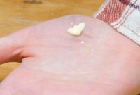 Effortless Splinter Removal Hack