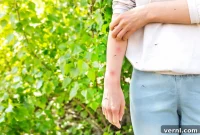 Ingenious Methods to Banish Mosquitoes