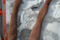 We Put the Ice Dam Pantyhose Hack to the Test Our Results