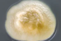 The Hidden Threat of Acremonium Mold
