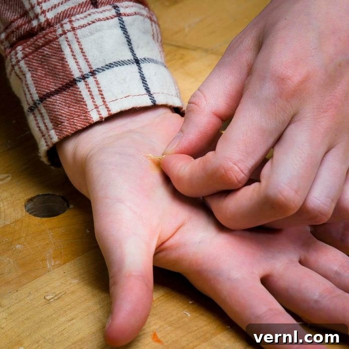 Effortless Splinter Removal Hack 3 Close-up of a hand with a visible splinter and a tube of wood glue, illustrating the effectiveness of the method